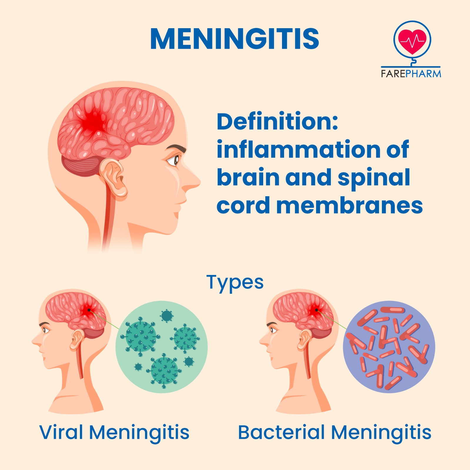 A little more about Meningitis