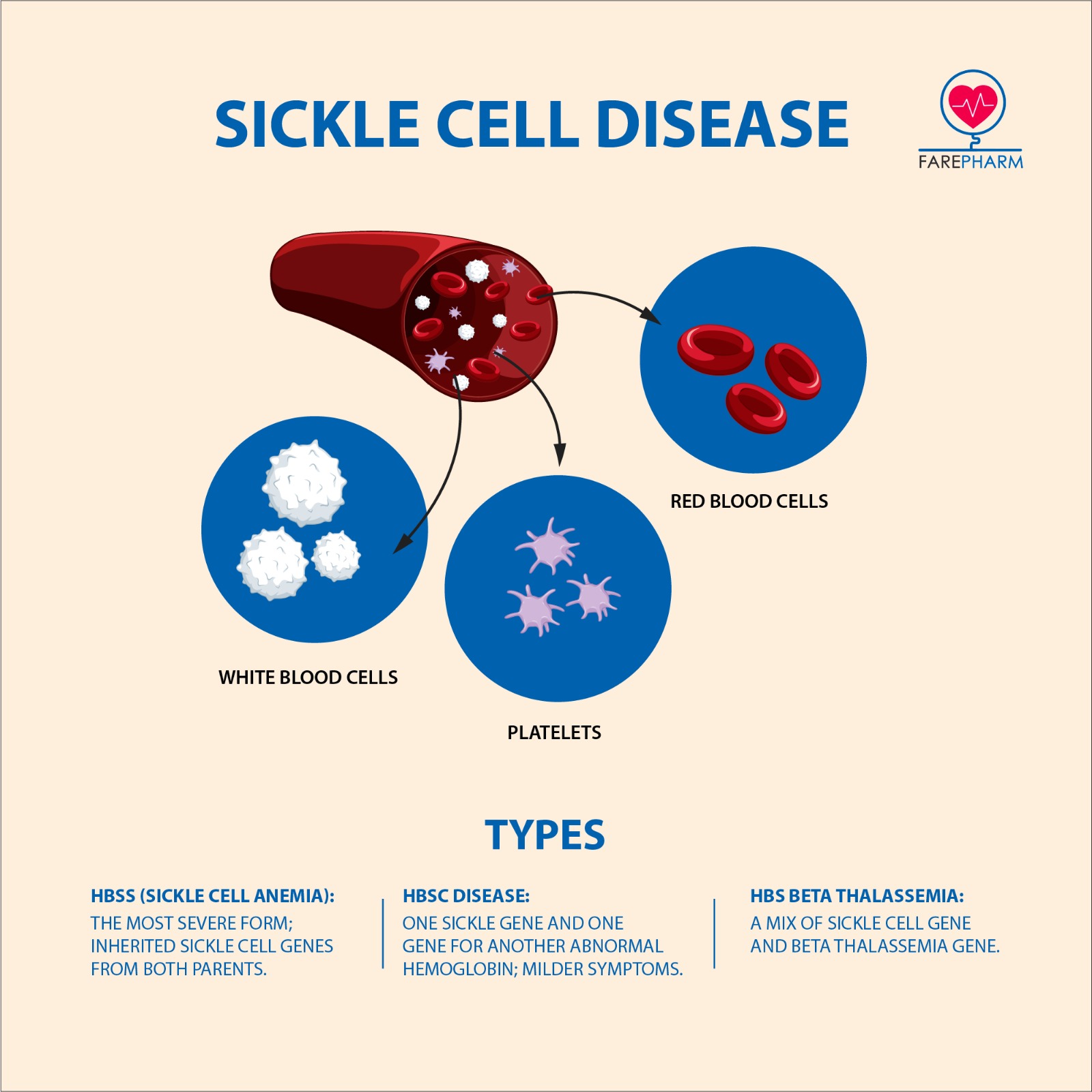 Sickle Cell Disease 